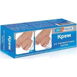 До и после крем от пигментных пятен 50мл